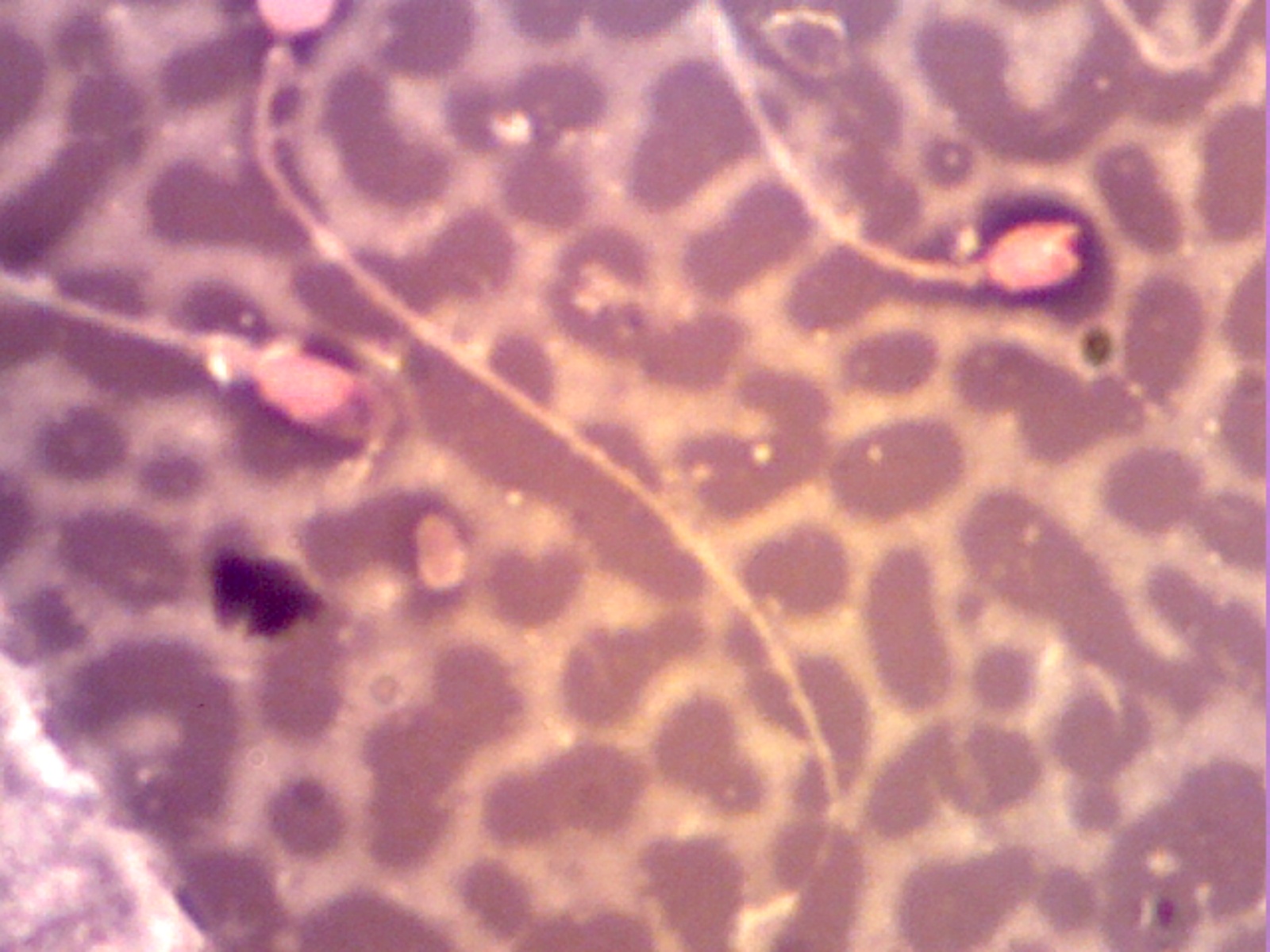 Επιλέχθηκε εικόνα